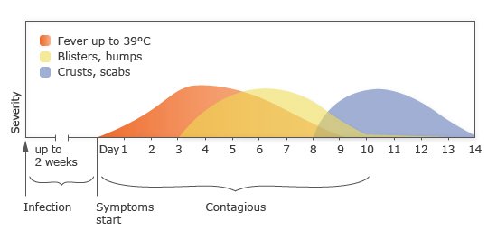 Chickenpox: Outlook and infectious period