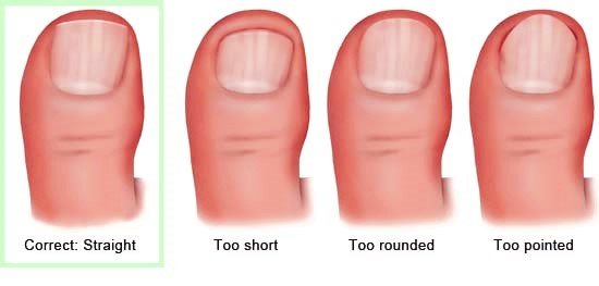 Illustration: The correct cutting technique – as described in the article