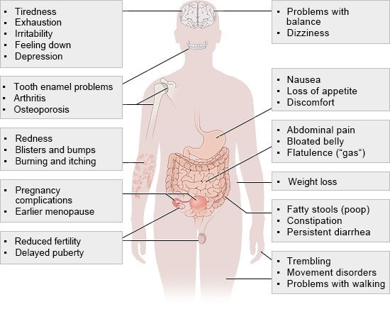 Illustration: Celiac disease – Effects of malnutrition caused by chronic inflammation in the intestine